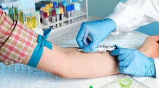 Tabagisme et test sanguin d'une veine